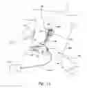 Fig. 02 - Extended pain relief via high frequency spinal cord modulation, and associated systems and methods