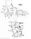 Fig. 02 - Device for applying cold therapy to feet