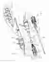 Fig. 02 - Conformable prosthesis delivery system and method for deployment thereof