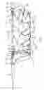 Fig. 06 - Conformable prosthesis delivery system and method for deployment thereof