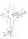 Fig. 01 - Embolic protection systems for bifurcated conduits