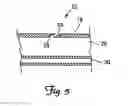 Fig. 04 - Embolic protection systems for bifurcated conduits