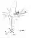 Fig. 10 - Embolic protection systems for bifurcated conduits