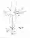 Fig. 11 - Embolic protection systems for bifurcated conduits