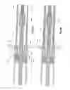 Fig. 12 - Controlled sequential deployment