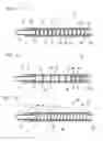 Fig. 09 - Stent delivery system