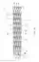 Fig. 12 - Stent delivery system