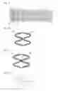 Fig. 04 - Stent