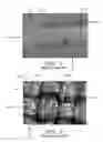 Fig. 02 - PROSTHETIC VALVES FORMED WITH ISOTROPIC FILTER SCREEN LEAFLETS