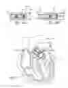 Fig. 16 - PROSTHETIC VALVES FORMED WITH ISOTROPIC FILTER SCREEN LEAFLETS