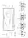 Fig. 15 - METHODS FOR PROSTHETIC VALVES FORMED WITH ISOTROPIC FILTER SCREEN LEAFLETS