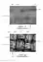 Fig. 02 - KITS WITH PROSTHETIC VALVES FORMED WITH ISOTROPIC FILTER SCREEN LEAFLETS AND METHODS THEREOF