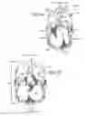 Fig. 09 - KITS WITH PROSTHETIC VALVES FORMED WITH ISOTROPIC FILTER SCREEN LEAFLETS AND METHODS THEREOF