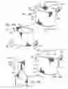 Fig. 10 - KITS WITH PROSTHETIC VALVES FORMED WITH ISOTROPIC FILTER SCREEN LEAFLETS AND METHODS THEREOF