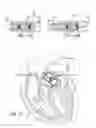 Fig. 16 - KITS WITH PROSTHETIC VALVES FORMED WITH ISOTROPIC FILTER SCREEN LEAFLETS AND METHODS THEREOF