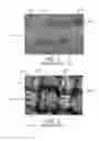 Fig. 02 - PROSTHETIC VALVES FORMED WITH SUPPORTING STRUCTURE AND ISOTROPIC FILTER SCREEN LEAFLETS