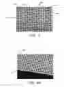 Fig. 03 - PROSTHETIC VALVES FORMED WITH SUPPORTING STRUCTURE AND ISOTROPIC FILTER SCREEN LEAFLETS