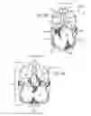 Fig. 09 - PROSTHETIC VALVES FORMED WITH SUPPORTING STRUCTURE AND ISOTROPIC FILTER SCREEN LEAFLETS