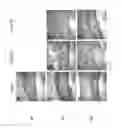 Fig. 10 - Silk fibroin hydrogels and uses thereof
