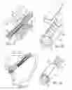 Fig. 04 - Method and apparatus for graft fixation