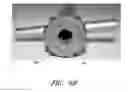 Fig. 13 - Buttress plate system