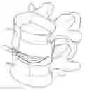 Fig. 01 - Intervertebral implant with multiple radii