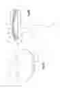 Fig. 04 - Intervertebral implant with multiple radii