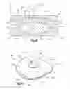 Fig. 09 - Intervertebral implant with multiple radii