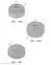 Fig. 24 - Prosthetic intervertebral discs having end plates and an annular capsule
