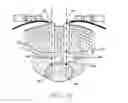 Fig. 40 - Prosthetic intervertebral discs having end plates and an annular capsule