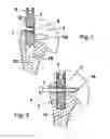Fig. 02 - Shoulder prosthesis with insert for locking screws