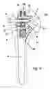 Fig. 04 - Shoulder prosthesis with insert for locking screws