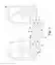 Fig. 03 - Knee prosthesis having commonly-sized patella components with varying thicknesses and peak surface diameters