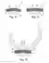Fig. 06 - Knee prosthesis having cross-compatible dome and anatomic patella components