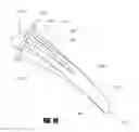 Fig. 14 - Stem for use in joint arthroplasty