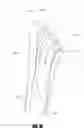 Fig. 16 - Stem for use in joint arthroplasty