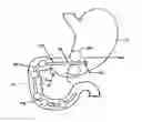 Fig. 01 - Methods and devices to curb appetite and/or reduce food intake