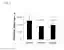 Fig. 29 - Gene and variations associate with BM1 phenotype, molecular markers, and their use