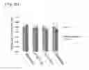 Fig. 31 - Recombinant DNA molecule encoding 5′ UTR capable of preventing inhibition of translation under environmental stresses