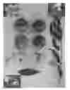 Fig. 02 - Nectarine tree named ‘Pearlicious II’
