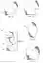 Fig. 08 - EXTREMITY ARMOR