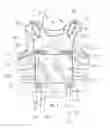 Fig. 02 - Rapid doffing vest