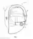 Fig. 02 - PROTECTIVE HEADGEAR ASSEMBLY