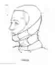 Fig. 04 - Dynamically reactive spinal support system