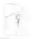 Fig. 01 - Gripping Zipper Securing Ring