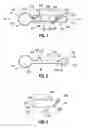 Fig. 02 - Locking clip and system