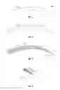 Fig. 03 - Apparatus for the Joining of Tissue Having Integral Penetrating End