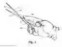 Fig. 02 - Scissor Handle Opening Sizer