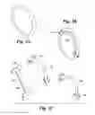 Fig. 04 - Scissor Handle Opening Sizer