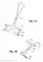 Fig. 06 - Scissor Handle Opening Sizer